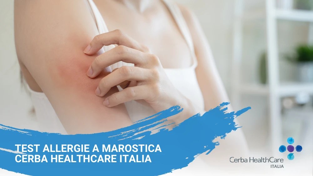 Test allergie a Marostica Cerba HealthCare Italia