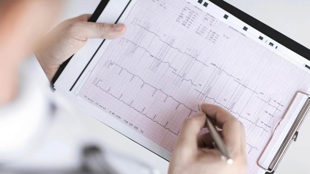 Grafico prova da sforzo - Aterosclerosi delle arterie coronarie cronica silente 