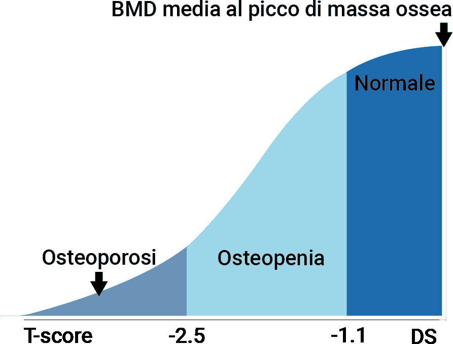 Tabella che indica quanto l'osteoporosi aumenti esponenzialmente il rischio fratture